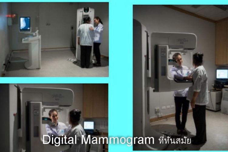 สรุปโครงการสืบสานพระราชปณิธานสมเด็จย่าต้านภัยมะเร็งเต้านม05