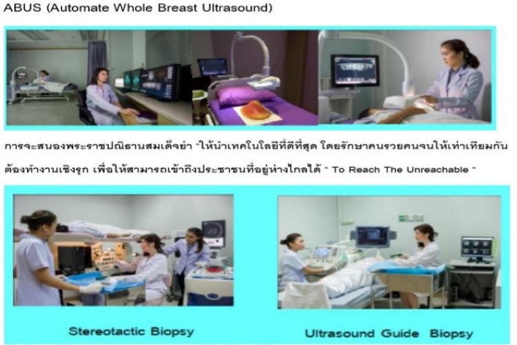 สรุปโครงการสืบสานพระราชปณิธานสมเด็จย่าต้านภัยมะเร็งเต้านม07