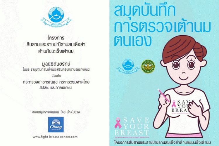 สรุปโครงการสืบสานพระราชปณิธานสมเด็จย่าต้านภัยมะเร็งเต้านม13