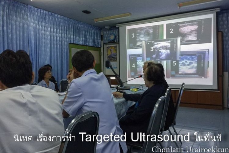 สรุปโครงการสืบสานพระราชปณิธานสมเด็จย่าต้านภัยมะเร็งเต้านม21